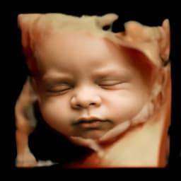 Example 6D ultrasound image