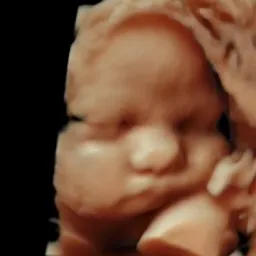 Black and white 3D ultrasound image of a baby